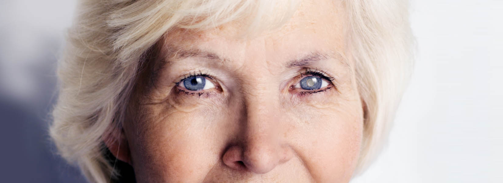 Cataract Surgery in Fond du Lac