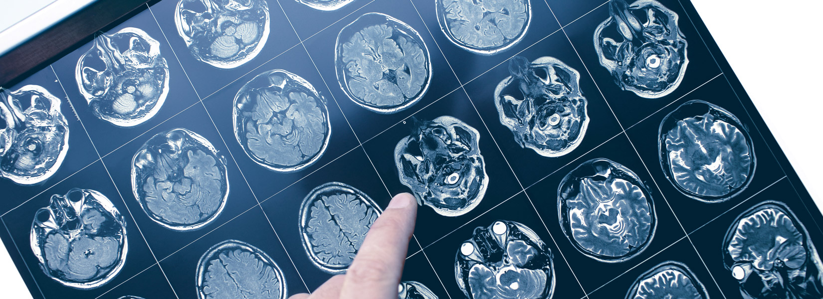 Neuro-Optometry in Fond du Lac